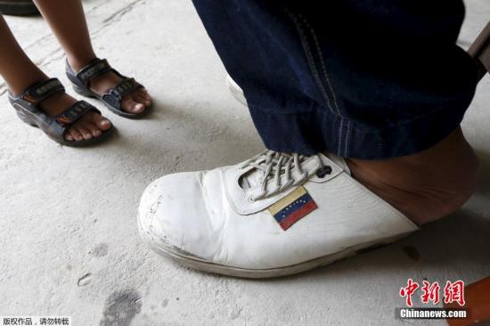 当地时间10月14日消息，委内瑞拉马拉凯，来自委内瑞拉19岁的年轻小伙杰森·罗德里格斯（Jeison Rodriguez） 拥有一双大脚，其右脚长40.1厘米，左脚长39.6厘米，打破吉尼斯世界纪录，成为世界上脚最大的人。