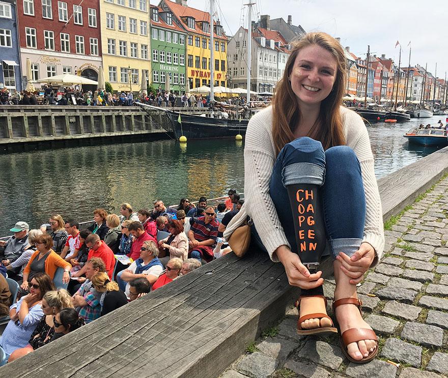 美国女孩晒独特毕业旅行照 假肢上写城市名字