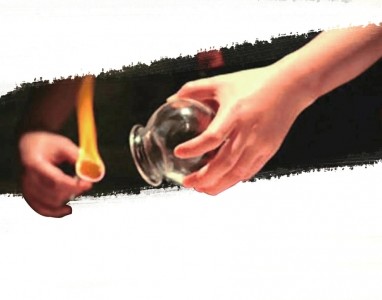 女子拔罐背部着火 女子拔罐背部着火