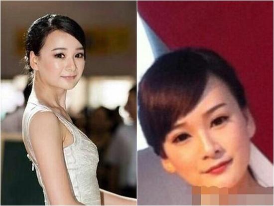 套路!杨幂替身整容前照片曝光 长得像原来是假的