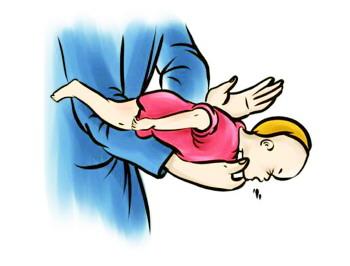 急救法海姆立克示意图 W020170325027168744458.jpg