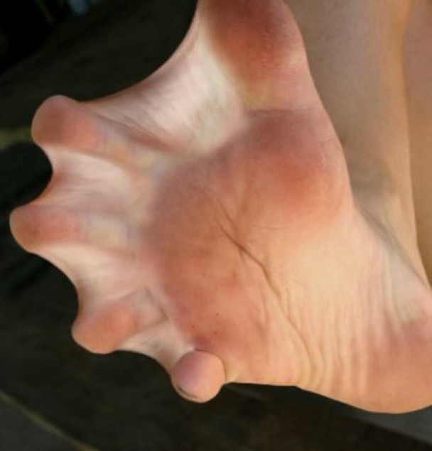 美国警方街头发现裸女 脚趾间有蹼自称美人鱼