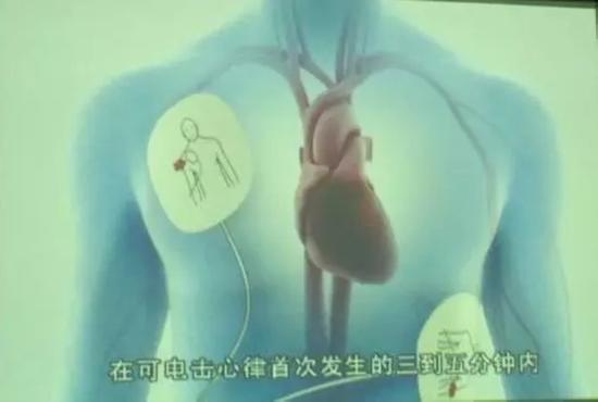 Ӱ�Ӿ��еĳ�ʶ�Դ���:����ǧ������ �籨������