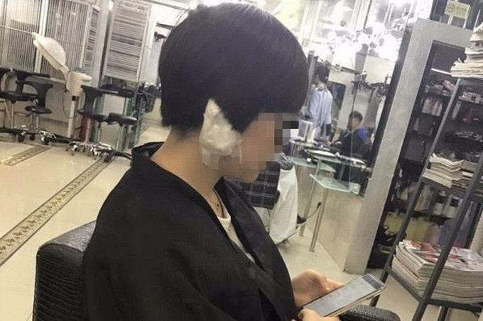 女子理发被剪耳垂 网友:行业门槛低 应增设上岗