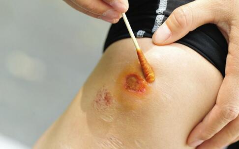 27��Ů�ӻ��� ��Ѫ֢��ԭ����ʲô ʲôԭ���°�Ѫ֢