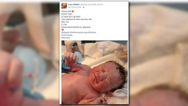 婴儿手握避孕环出生