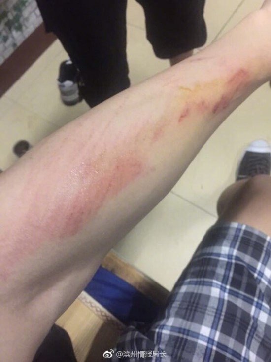 情侣校园搂抱被殴 情侣校园搂抱被殴