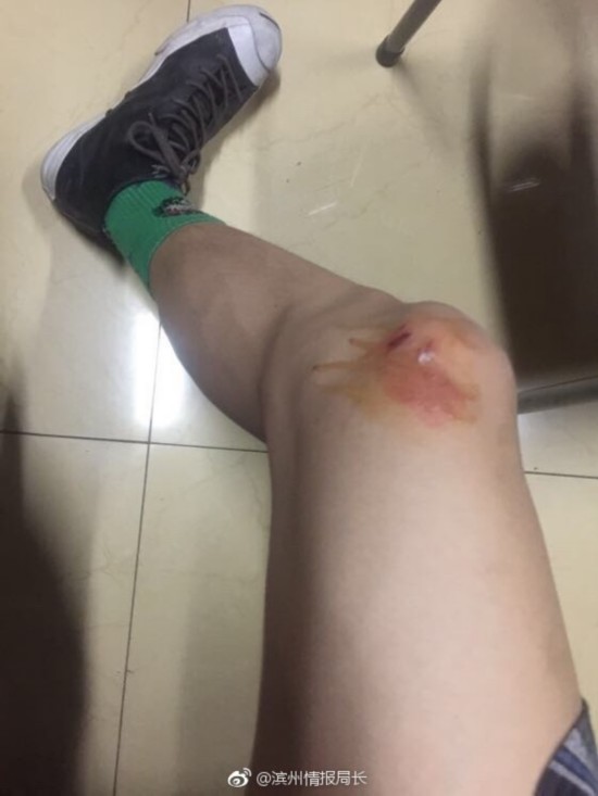 情侣校园搂抱被殴 情侣校园搂抱被殴