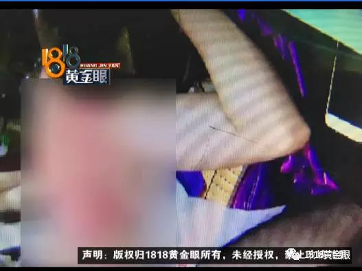 女顾客光身子做保养 老板娘拍视频发他人自称无意