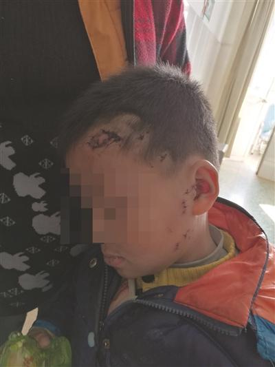 6���к���һ�׶�ߡ���������ҧ ���촽��㱻˺��