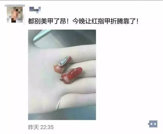 19����ʦ������ָ��˲��ק�ϣ�������׾�������