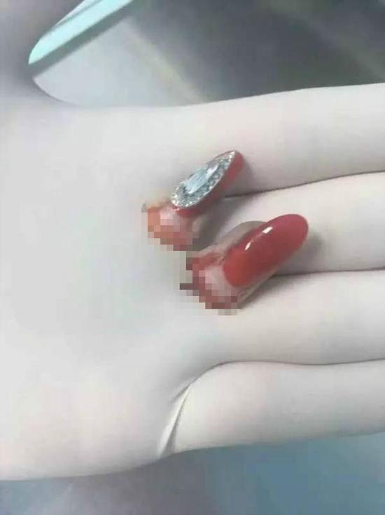 19����ʦ������ָ��˲��ק�ϣ�������׾�������