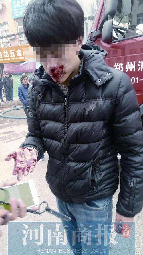 河南郑州多名记者采访时遭殴打 事发地乡政府致歉