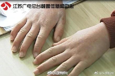 女童吃垃圾桶剩菜度日 父母将其锁家中拒绝援助星空体育入口(图1)