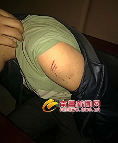 ���ӻ������Ӻ��ӳ�ǽ �õ����ֱ��Բ�������