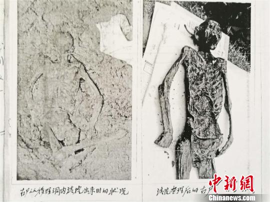 ����ͼ��ͼΪս����ʬ����������ǰ��ͼƬ