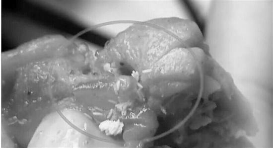 浙江孕妇吃肯德基吃出一堆苍蝇卵 店方回应