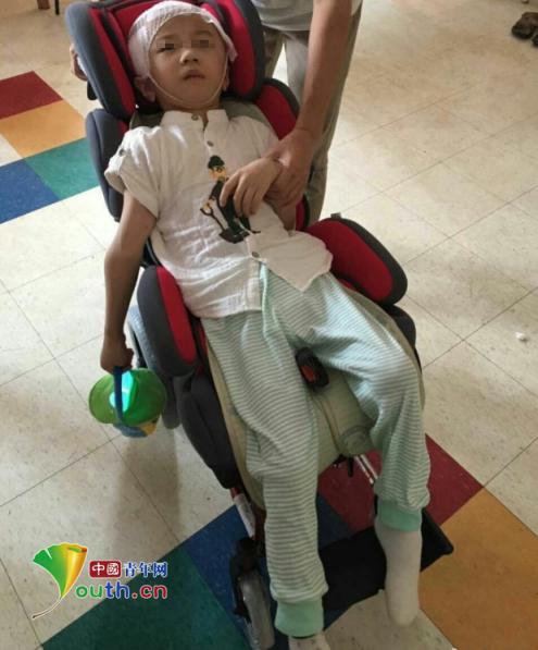 陕西6岁男童遭继母虐待近半年75%颅骨缺损 律