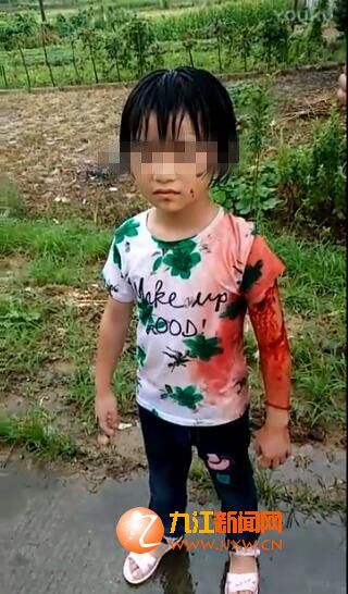 8岁女孩遭陌生女子从教室拐走砍伤 独行数公里