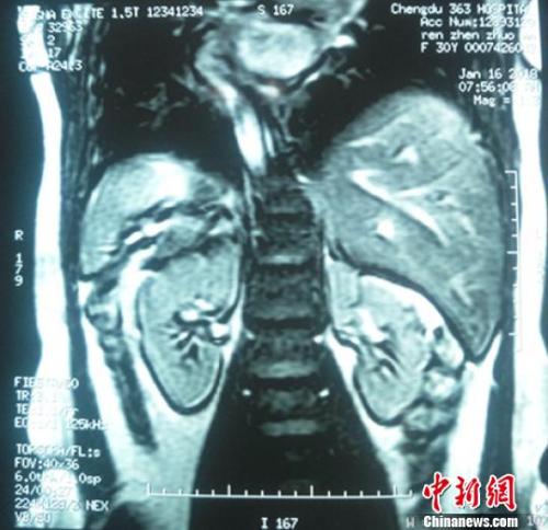 �����˺˴Ź����黭��,����λ���볣���෴�������� ��