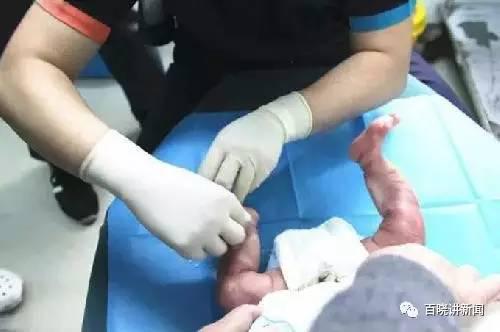 ����Ӥ��˫��͸��