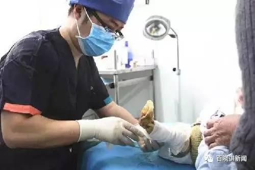 出生婴儿双腿透明 出生婴儿双腿透明