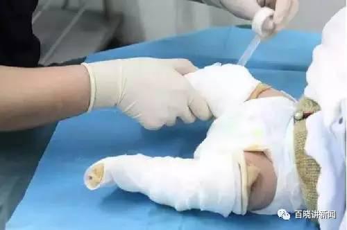 ����Ӥ��˫��͸��