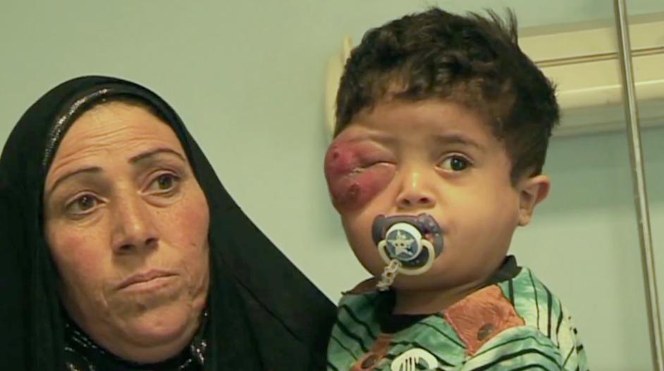 太惨了这就是种族灭绝