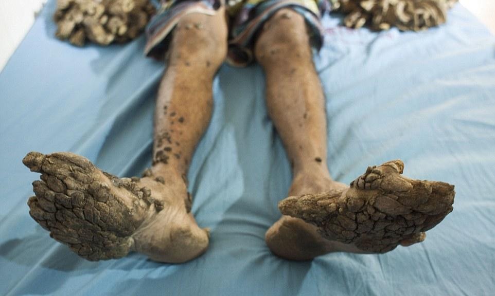 女子电磁过敏为避wifi住棚屋细数全球可怕的疑难杂症