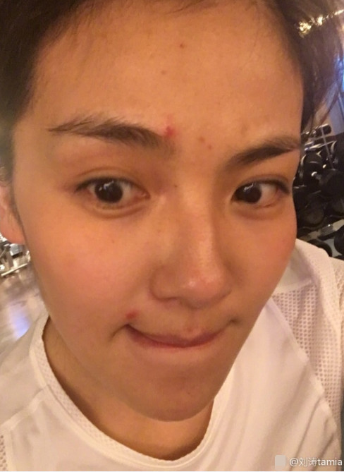 刘涛素颜怎么看怎么美长了痘痘反而更少女了