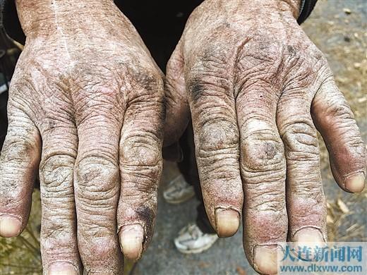 母亲的手写满岁月沧桑