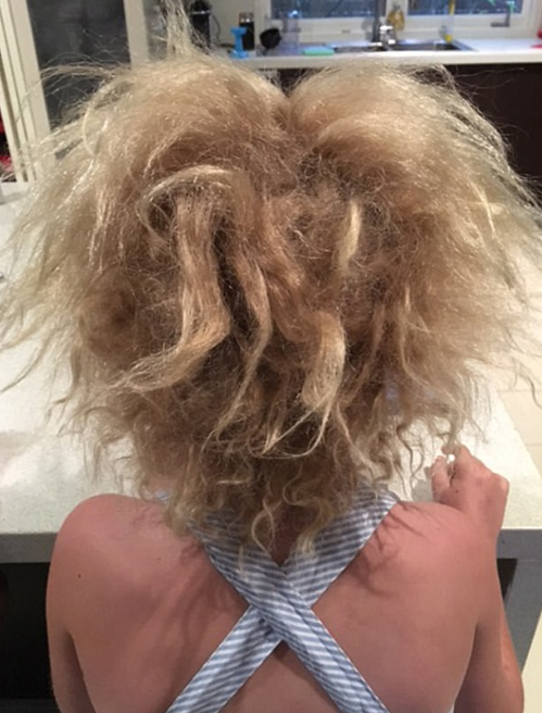 澳大利亚7岁女孩患罕见蓬发综合征 头发蓬乱难打理
