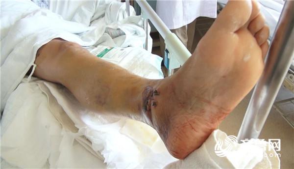 退伍军人见义勇为被打断腿再遇这种事我还去帮忙