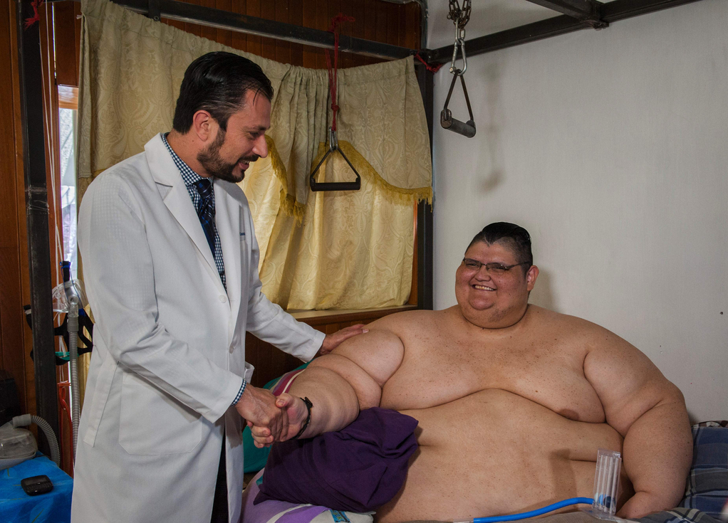 世界最重男4月狂减340斤
