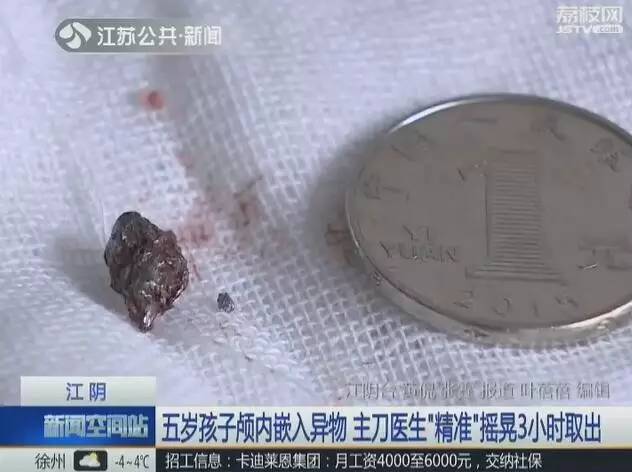 5�������ӽ����� ҽ������ͷ��ҡ����3Сʱ