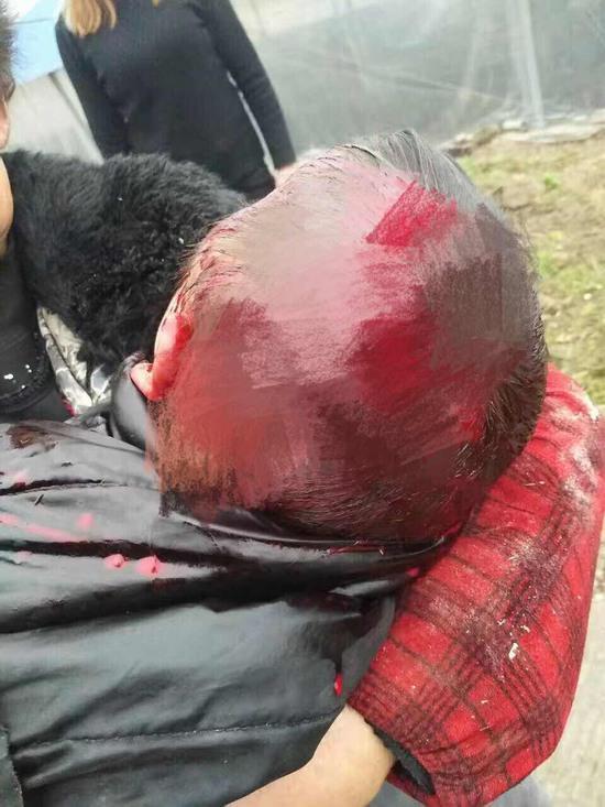 3岁男孩被女子砍数刀村民称行凶者患有精神病